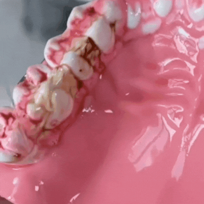 Hydropulseur Dentaire pour un Sourire Éclatant